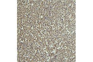 IHC analysis of CD69 using anti-CD69 antibody (ABIN7599623). (CD69 anticorps  (AA 101-148))