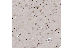 Immunohistochemical staining of human cerebral cortex with ZEB1 polyclonal antibody  shows strong nuclear positivity in glial cells at 1:500-1:1000 dilution. (ZEB1 anticorps)