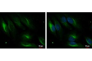 ICC/IF Image PDLIM4 antibody [C2C3], C-term detects PDLIM4 protein at cytoplasm by immunofluorescent analysis.