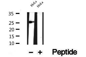 Western blot analysis of extracts of HeLa cells, using SNRPB2 antibody.