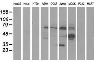 Western blot analysis of extracts (35 µg) from 9 different cell lines by using anti-KLHL2 monoclonal antibody. (KLHL2 anticorps  (AA 1-100, AA 494-593))