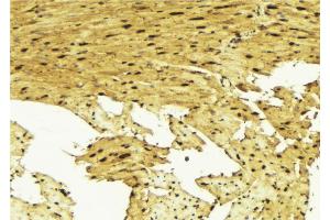 ABIN6267661 at 1/100 staining Mouse muscle tissue by IHC-P.
