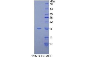 SDS-PAGE (SDS) image for NADH Dehydrogenase (Ubiquinone) 1, alpha/beta Subcomplex, 1, 8kDa (NDUFAB1) (AA 5-129) protein (His tag) (ABIN1878691)