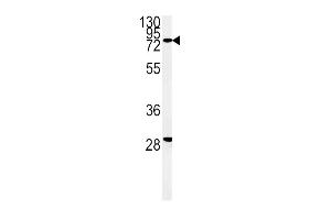Western blot analysis of ZFYVE16 Antibody (N-term) (ABIN651313 and ABIN2840182) in K562 cell line lysates (35 μg/lane). (ZFYVE16 anticorps  (N-Term))