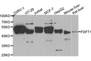 Western Blotting (WB) image for anti-Farnesyl-Diphosphate Farnesyltransferase 1 (FDFT1) antibody (ABIN1882356) (FDFT1 anticorps)