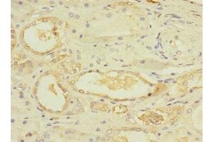 Immunohistochemistry of paraffin-embedded human kidney tissue using ABIN7174375 at dilution of 1:100 (UBE4A anticorps  (AA 797-1066))
