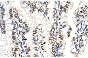 Human Intestine (SNX29 anticorps  (N-Term))