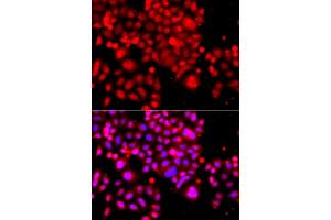 Immunofluorescence analysis of  cells using  antibody (ABIN6133295, ABIN6137172, ABIN6137173 and ABIN6223966). (ASCC3 anticorps  (AA 1-111))