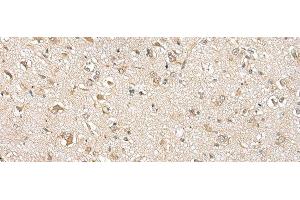 Immunohistochemistry of paraffin-embedded Human brain tissue using NUDT10 Polyclonal Antibody at dilution of 1:70(x200)