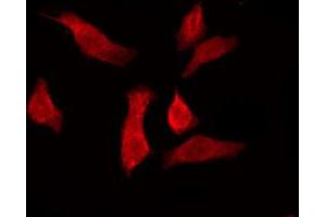 ABIN6274569 staining Hela by IF/ICC.