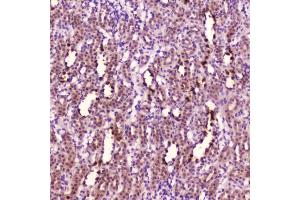 IHC testing of FFPE rat kidney tissue with Leptin antibody at 2ug/ml. (Leptin anticorps  (AA 22-167))