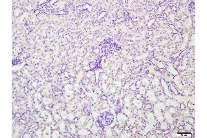 Paraformaldehyde-fixed, paraffin embedded Mouse kidney, Antigen retrieval by boiling in sodium citrate buffer (pH6.