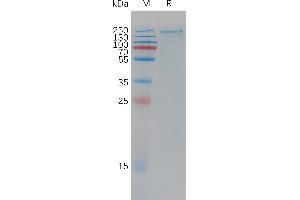 Human Protein, His Tag on SDS-PAGE under reducing condition.