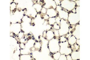 Immunohistochemistry of paraffin-embedded Mouse lung using PHF11 Polyclonal Antibody at dilution of 1:100 (40x lens).