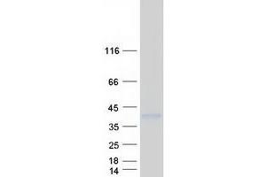 Validation with Western Blot