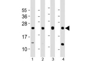 Western blot testing of human 1) A431, 2) HeLa, 3) HepG2 and 4) MCF-7 cell lysate with LITAF antibody at 1:1000. (LITAF anticorps  (AA 31-60))