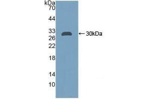 Detection of Recombinant CA2, Rat using Polyclonal Antibody to Carbonic Anhydrase II (CA2) (CA2 anticorps  (AA 1-260))