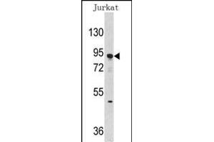 Western blot analysis of anti-DNMT3A Antibody (Center ) (ABIN387882 and ABIN2844093) in Jurkat cell line lysates (35 μg/lane). (DNMT3A anticorps  (AA 457-486))
