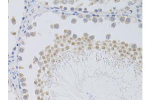 Immunohistochemistry of paraffin-embedded rat testis using PHC1 antibody (ABIN5973455) at dilution of 1/100 (40x lens). (PHC1 anticorps)