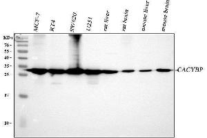 Western blot analysis of CACYBP using anti-CACYBP antibody (ABIN4886495). (CACYBP anticorps  (N-Term))