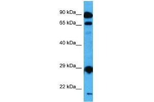 Host:  Mouse  Target Name:  MED6  Sample Tissue:  Mouse Testis  Antibody Dilution:  1ug/ml (MED6 anticorps  (Middle Region))