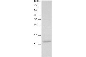 Western Blotting (WB) image for Chemokine (C-C Motif) Ligand 28 (CCL28) (AA 20-135) protein (His-IF2DI Tag) (ABIN7122297)