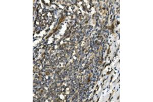 IHC analysis of TRIM25 using anti-TRIM25 antibody (ABIN7599495). (TRIM25 anticorps  (AA 1-610))