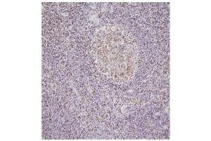 Immunohistochemistry This image shows paraffin-embedded human palatine tonsil tissue sample stained with anti-NPM antibody(5E3) at 1:100 dilution.