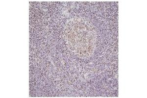 Immunohistochemistry This image shows paraffin-embedded human palatine tonsil tissue sample stained with anti-NPM antibody(5E3) at 1:100 dilution. (NPM1 anticorps)