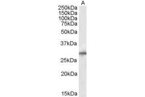 ABIN184675 staining (1µg/ml) of Human Liver lysate (RIPA buffer, 35µg total protein per lane).