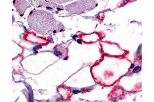 Anti-VIP Receptor 1 antibody IHC of human adipocytes.