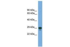 Image no. 1 for anti-Paired Related Homeobox 2 (PRRX2) (AA 71-120) antibody (ABIN6745633) (PRRX2 anticorps  (AA 71-120))
