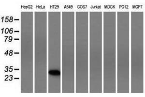 Image no. 2 for anti-Four and A Half LIM Domains 1 (FHL1) antibody (ABIN1500976)