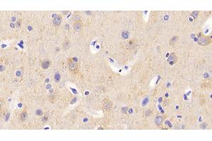 Detection of CAMLG in Human Cerebrum Tissue using Polyclonal Antibody to Calcium Modulating Ligand (CAMLG)