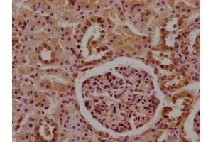 IHC image of ABIN7148399 diluted at 1:100 and staining in paraffin-embedded human kidney tissue performed on a Leica BondTM system. (CFHR5 anticorps  (AA 374-569))
