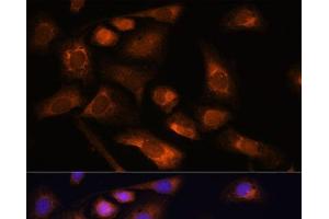 Immunofluorescence analysis of U-2 OS cells using RPS13 Polyclonal Antibody at dilution of 1:100. (RPS13 anticorps)
