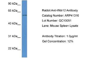 Western Blotting (WB) image for anti-WD Repeat Domain 12 (WDR12) (Middle Region) antibody (ABIN2776744)