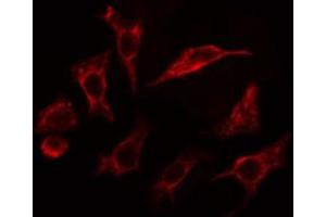 ABIN6267393 staining Hela cells by IF/ICC.