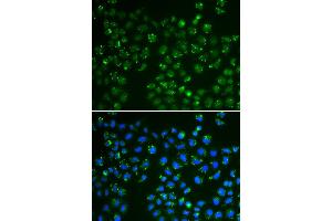 Immunofluorescence analysis of A549 cells using GPX4 antibody (ABIN6294188). (GPX4 anticorps)