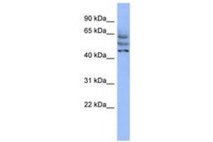 Image no. 1 for anti-Coiled-Coil Domain Containing 174 (CCDC174) (AA 215-264) antibody (ABIN6744101) (CCDC174 anticorps  (AA 215-264))