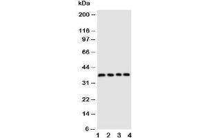 Western blot testing of CD1d antibody and Lane 1:  COLO320;  2: HeLa;  3: HT1080;  4: Jurkat cell lysate (CD1d anticorps  (AA 76-92))