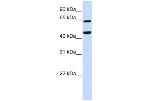 TRIM54 antibody used at 1 ug/ml to detect target protein. (TRIM54 anticorps  (N-Term))