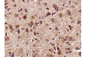 Paraformaldehyde-fixed, paraffin embedded mouse brain, Antigen retrieval by boiling in sodium citrate buffer (pH6) for 15min, Block endogenous peroxidase by 3% hydrogen peroxide for 30 minutes, Blocking buffer (normal goat serum) at 37°C for 20min, Antibody incubation with DCTN3 Polyclonal Antibody at 1:400 overnight at 4°C, followed by a conjugated secondary and DAB staining