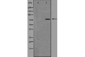 Western blot analysis of extracts from HepG2 cells using SLCO1A2 antibody. (SLCO1A2 anticorps  (Internal Region))