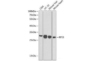 Western blot analysis of extracts of various cell lines using RPS3 Polyclonal Antibody at dilution of 1:1000. (RPS3 anticorps)