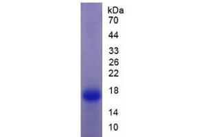 SDS-PAGE analysis of Rat Transthyretin Protein. (TTR Protéine)