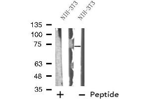 Western blot analysis of ABCG5 using NIH-3T3 whole cell lysates