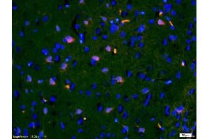 Formalin-fixed and paraffin-embedded rat brain labeled with Anti-IGFBP3 Polyclonal Antibody, Unconjugated (ABIN686497) 1:200, overnight at 4°C, The secondary antibody was Goat Anti-Rabbit IgG,Cy3 conjugated used at 1:200 dilution for 40 minutes at 37°C.