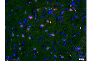 Formalin-fixed and paraffin-embedded rat brain labeled with Anti-IGFBP3 Polyclonal Antibody, Unconjugated (ABIN686497) 1:200, overnight at 4°C, The secondary antibody was Goat Anti-Rabbit IgG,Cy3 conjugated used at 1:200 dilution for 40 minutes at 37°C. (IGFBP3 anticorps  (AA 186-292))