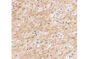 Immunohistochemical staining of human brain tissue using AP30032PU-N AIFM3 antibody at 2. (AIFM3 anticorps  (N-Term))
